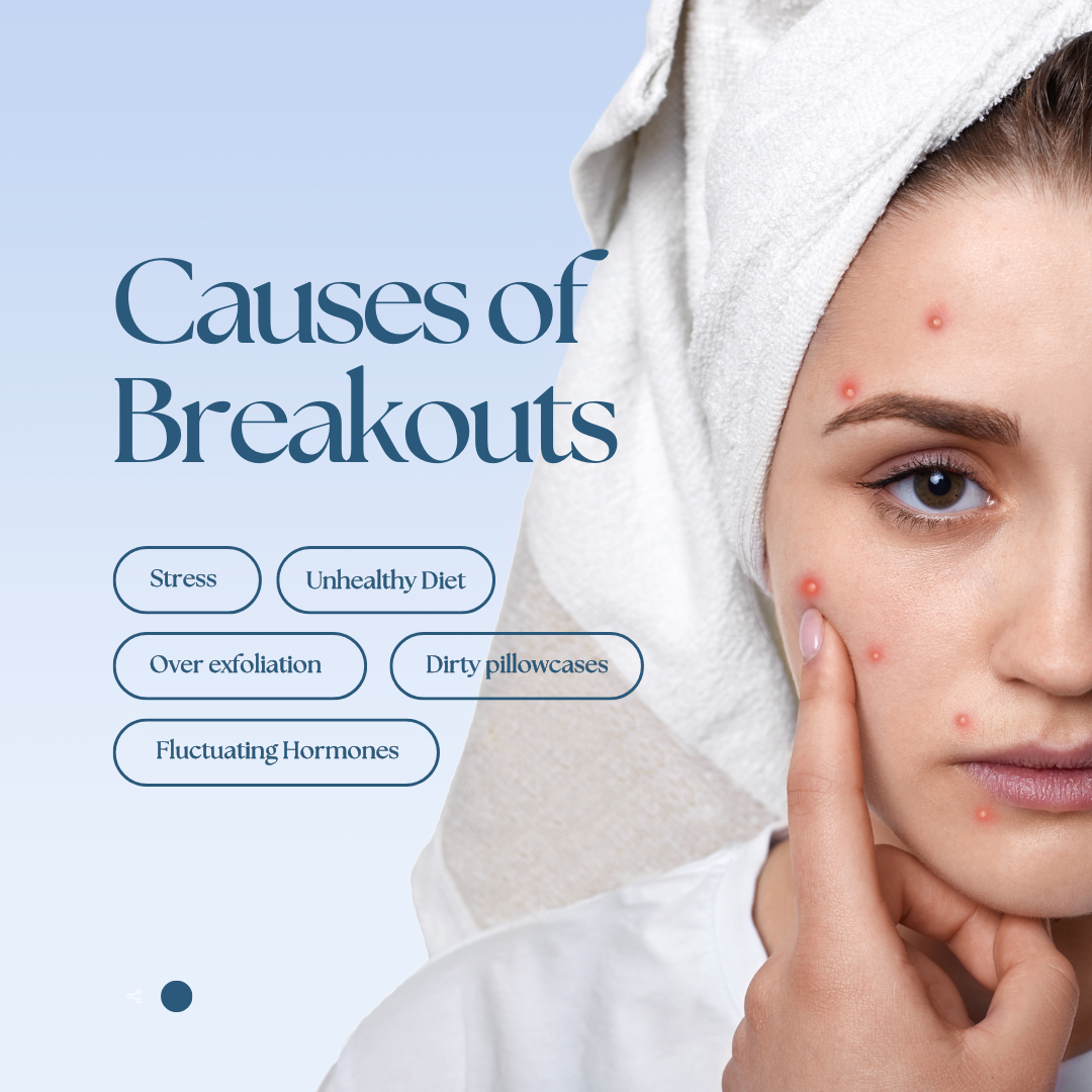 How to Treat Acne: Practical Advice and Remedies